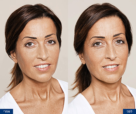Before-After-Photos-3